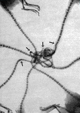Un examen aux rayons X a montré que les queues des rats ne poussaient pas ensemble, mais étaient reliées entre elles par un nœud complexe.