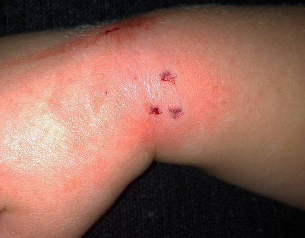 En règle générale, un rat est limité à une bouchée, faite pour se protéger ...