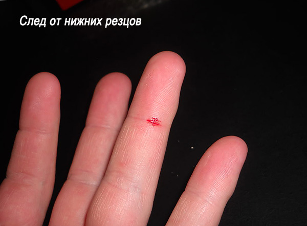 Trace des incisives inférieures du rat.