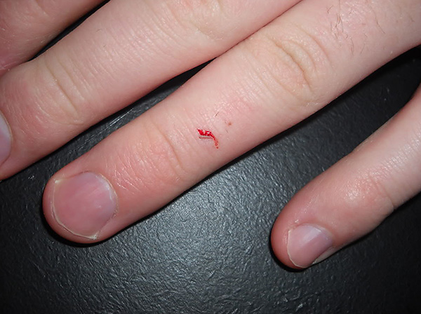Le rat a mordu au sang - une trace de saignement des incisives est visible.