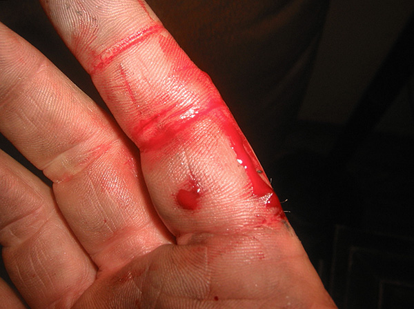 En raison de la présence d'incisives tranchantes, les rats sont souvent piqués au sang.