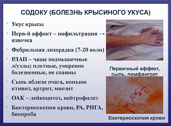 Sodoku est autrement appelé une maladie de morsure de rat.