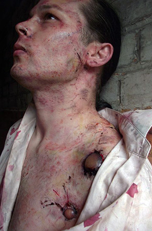 Des cas de peste humaine se produisent encore aujourd'hui.